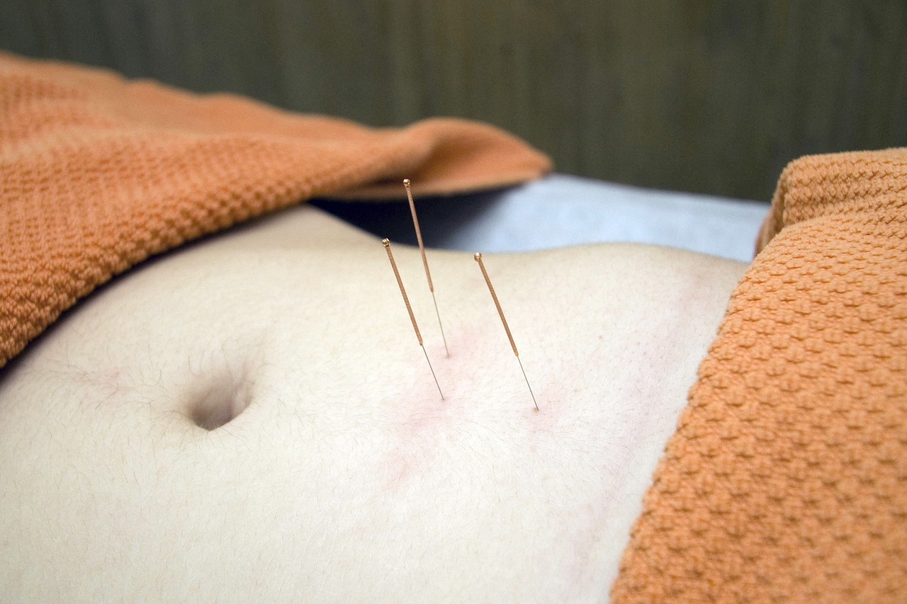 The Philosophy of Acupuncture – Substantiating the Science